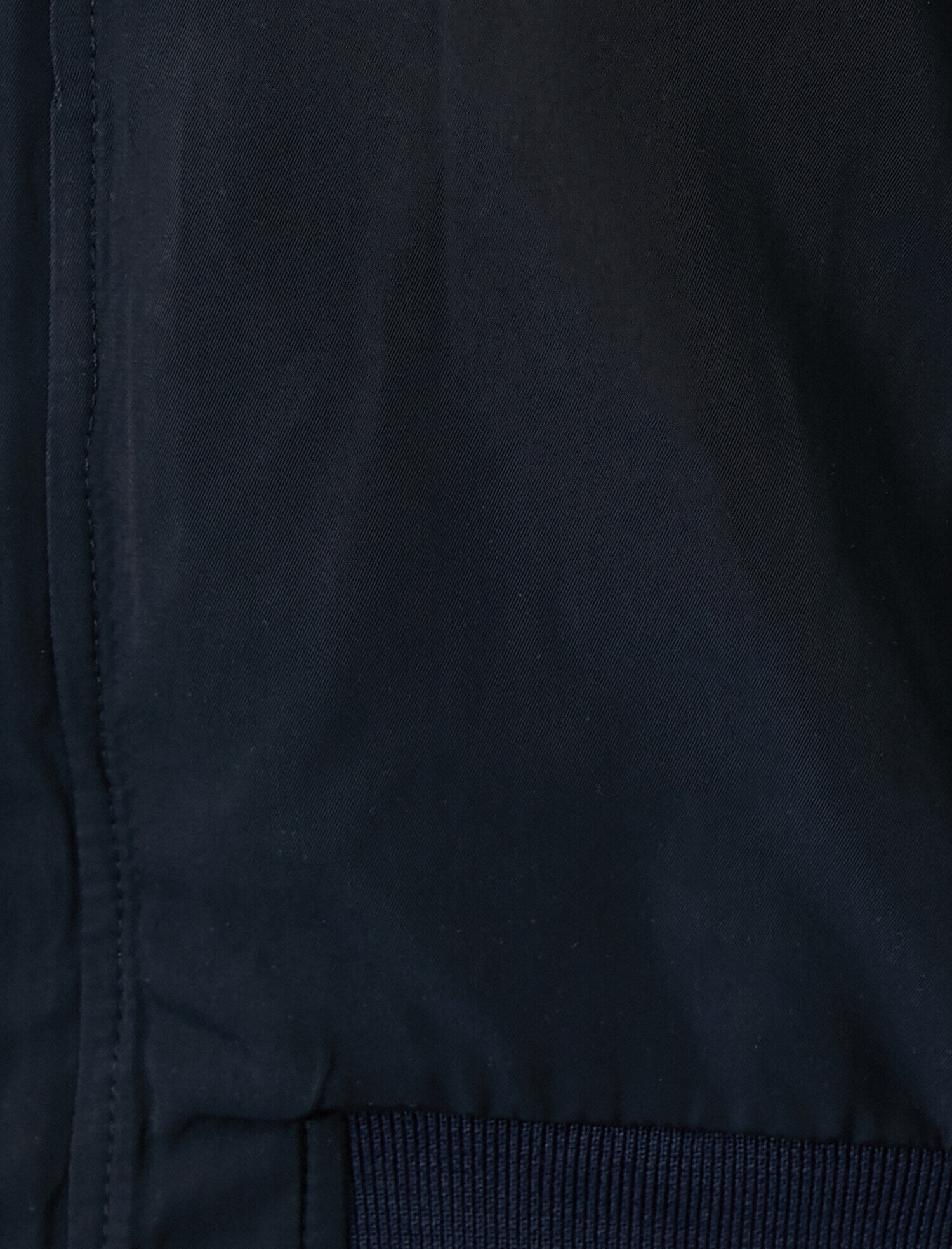   Çizgili Ribanalı Fermuarlı Mont