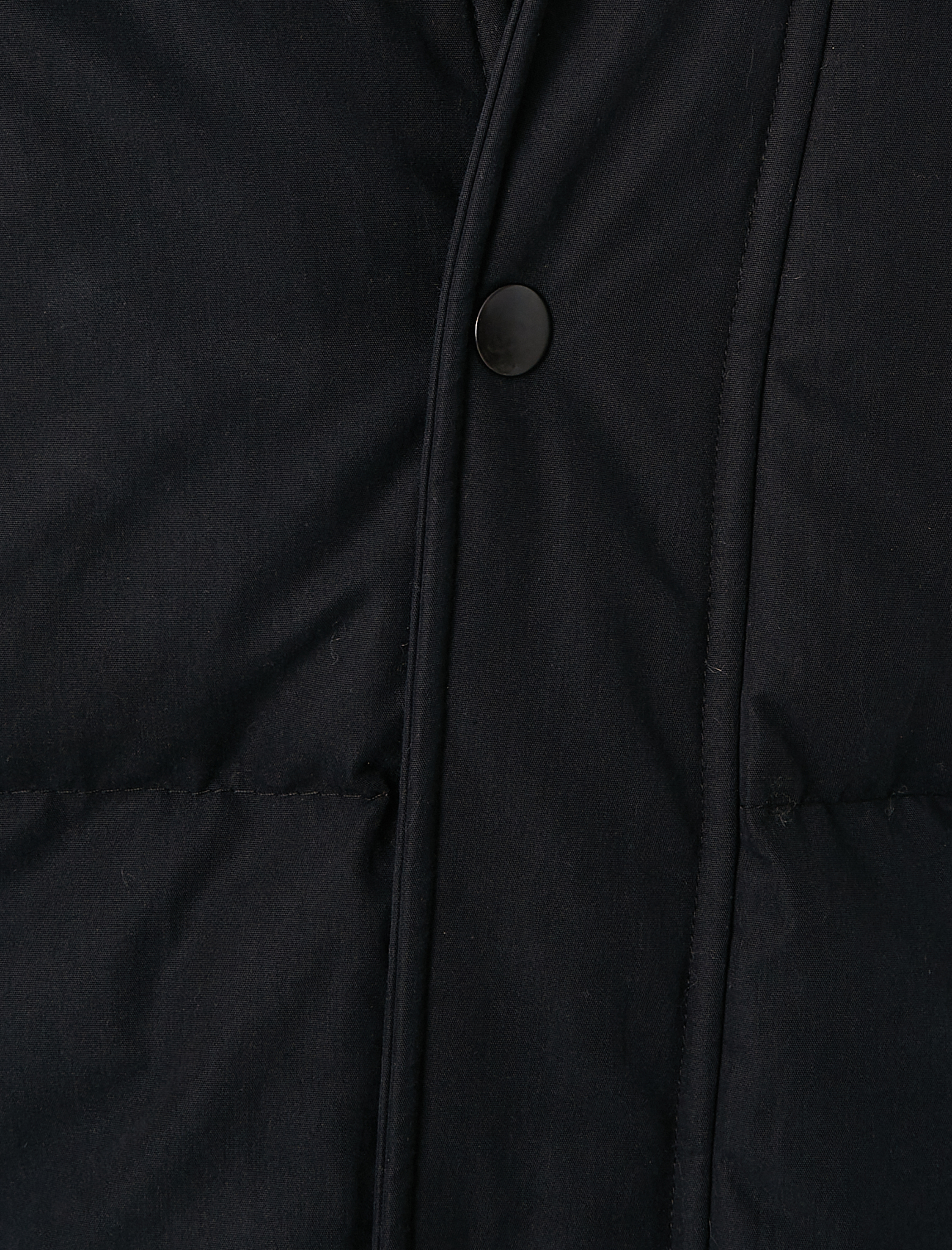   Anorak Kapşonlu Şişme Mont Cepli Yaka Detaylı Fermuarlı