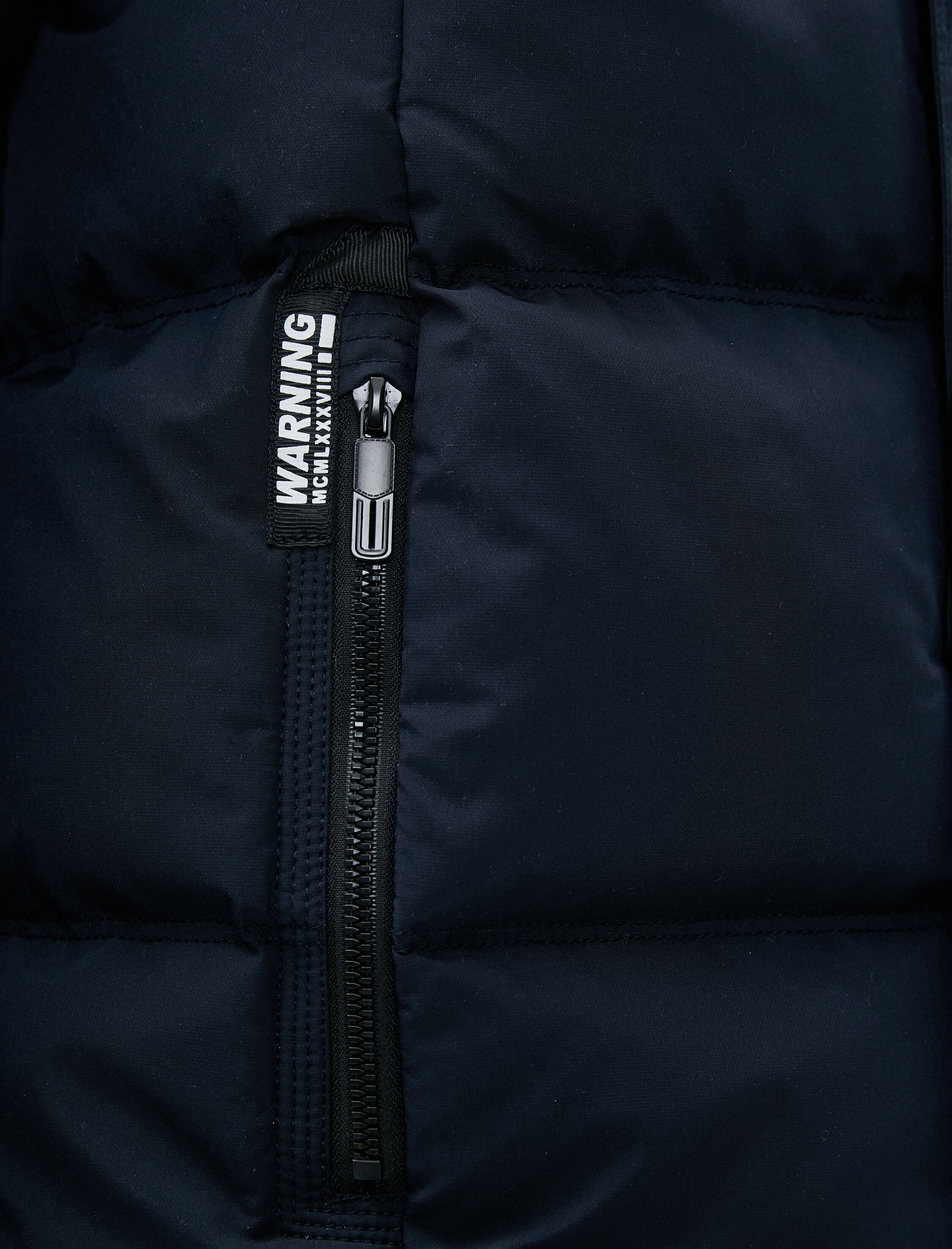   Şişme Mont Çıkarılabilir Kapşonlu Fermuar Detaylı