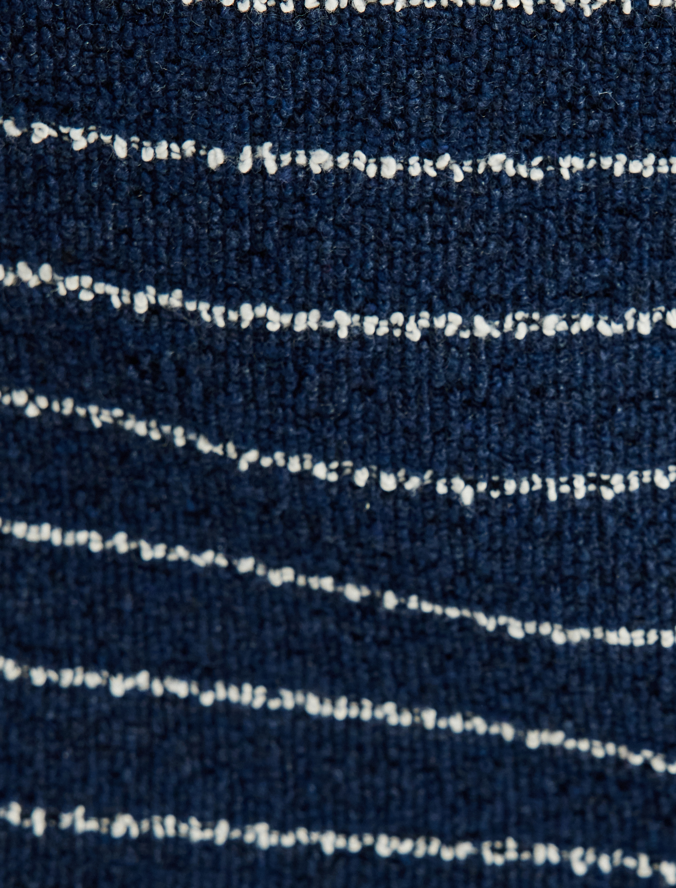   Mini Düğmeli Tüvit Şort Etek