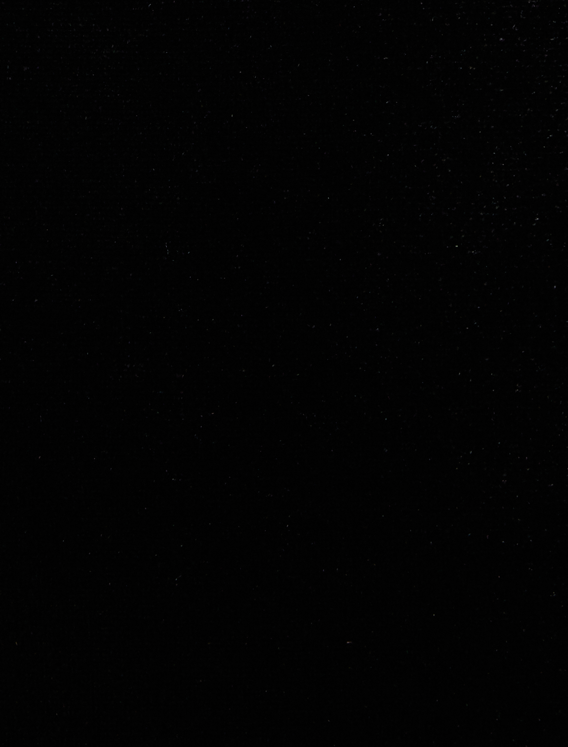   Mini Elbise V Dantel Yaka 3/4 Kol Düğme Detaylı