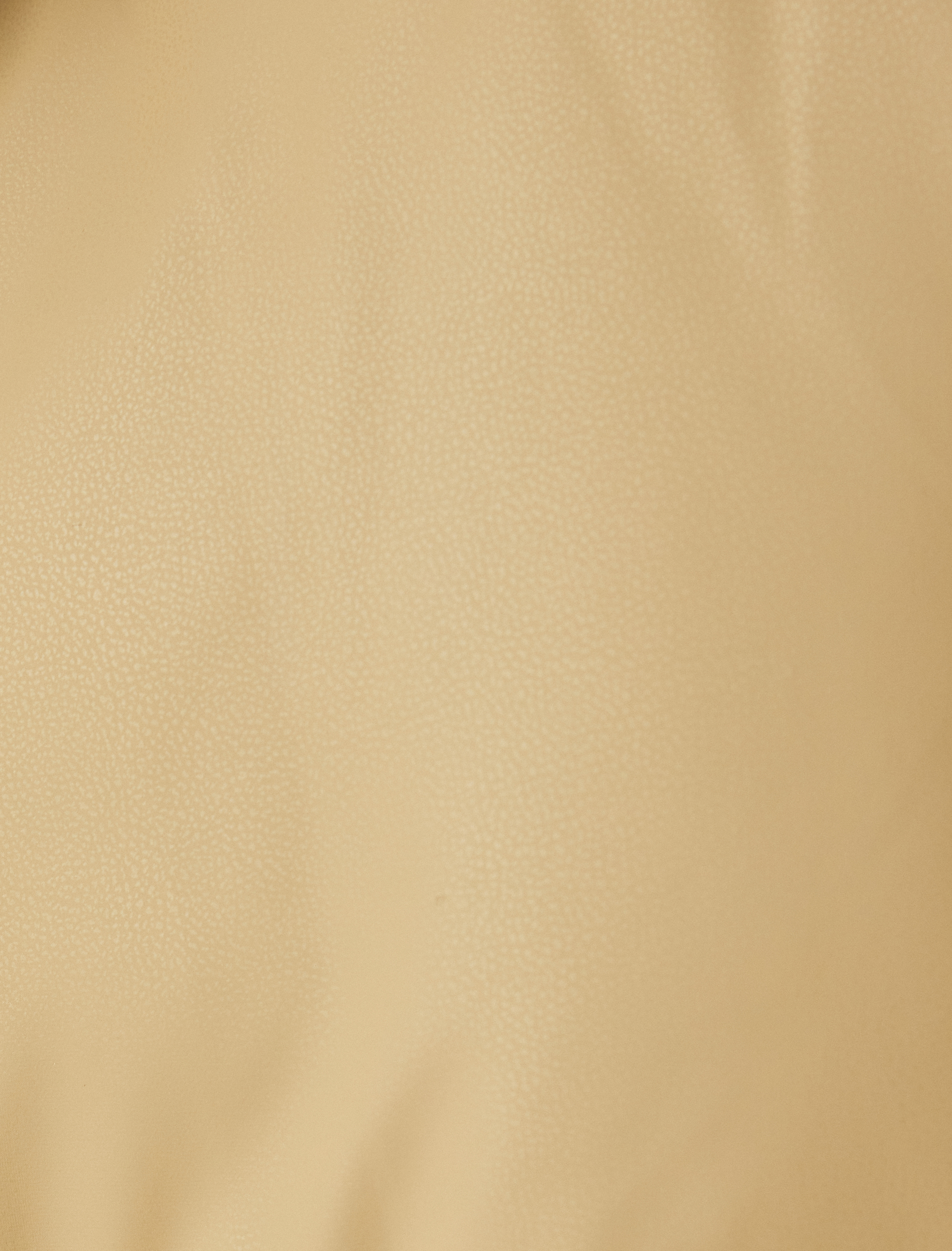   Kapüşonlu Slim Fit Fermuarlı Suni Deri Şişme Mont